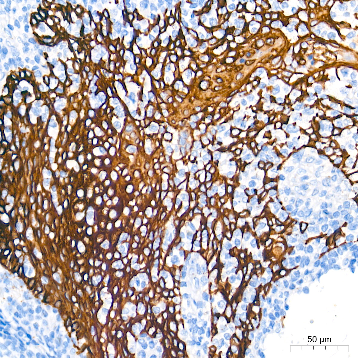 Cytokeratin 5 Rabbit Monoclonal Antibody - Image 11