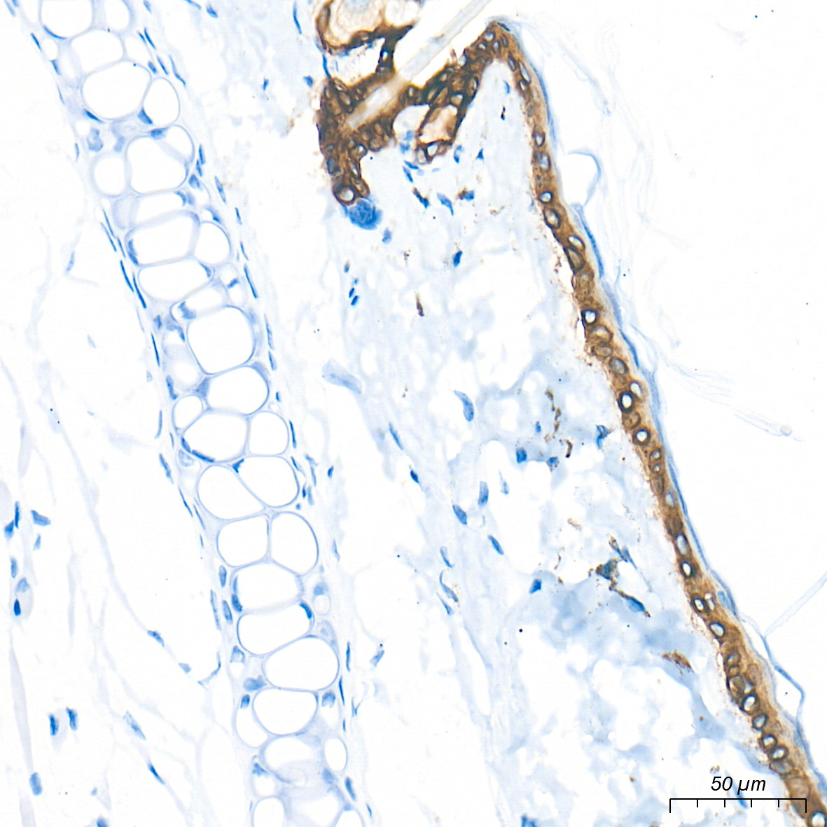 Cytokeratin 5 Rabbit Monoclonal Antibody - Image 12
