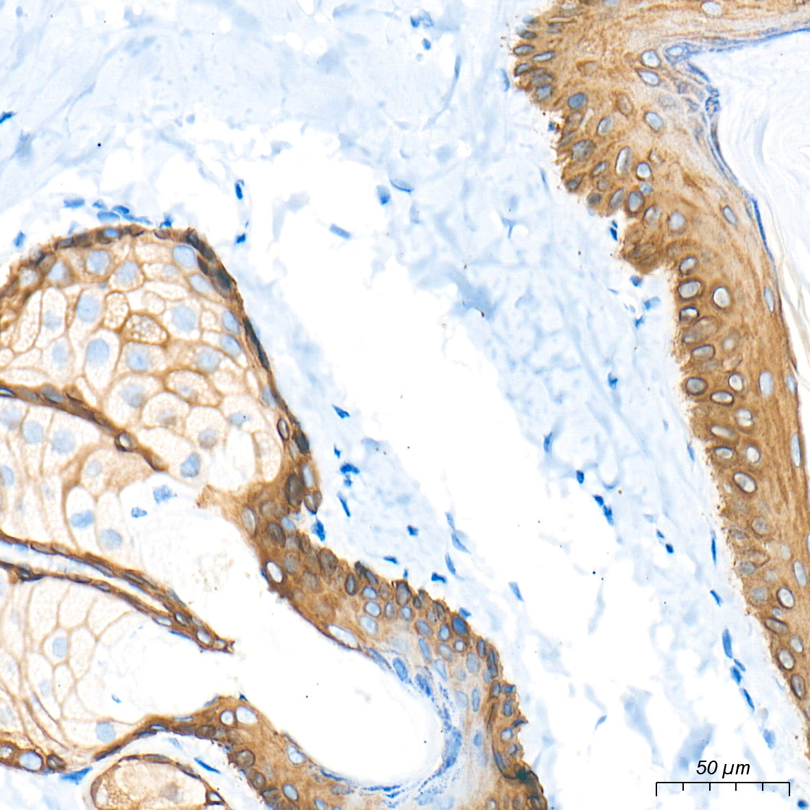 Cytokeratin 5 Rabbit Monoclonal Antibody - Image 13