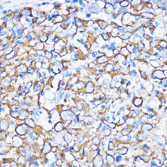 Cytokeratin 5 Rabbit Polyclonal Antibody - Image 2