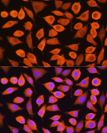 Cytokeratin 5 Rabbit Polyclonal Antibody - Image 3