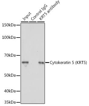 Cytokeratin 5 Rabbit Polyclonal Antibody - Image 4