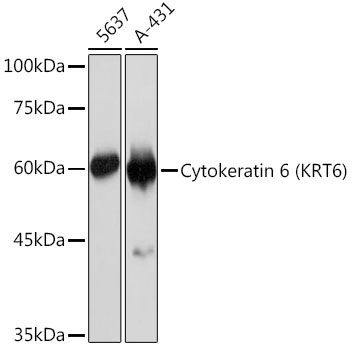 Cytokeratin 6 (KRT6) Rabbit Monoclonal Antibody