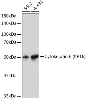 Cytokeratin 6 (KRT6) Rabbit Monoclonal Antibody