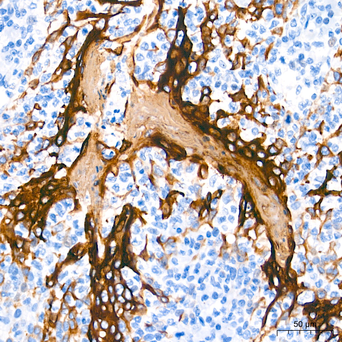 Cytokeratin 6 (KRT6) Rabbit Monoclonal Antibody - Image 2