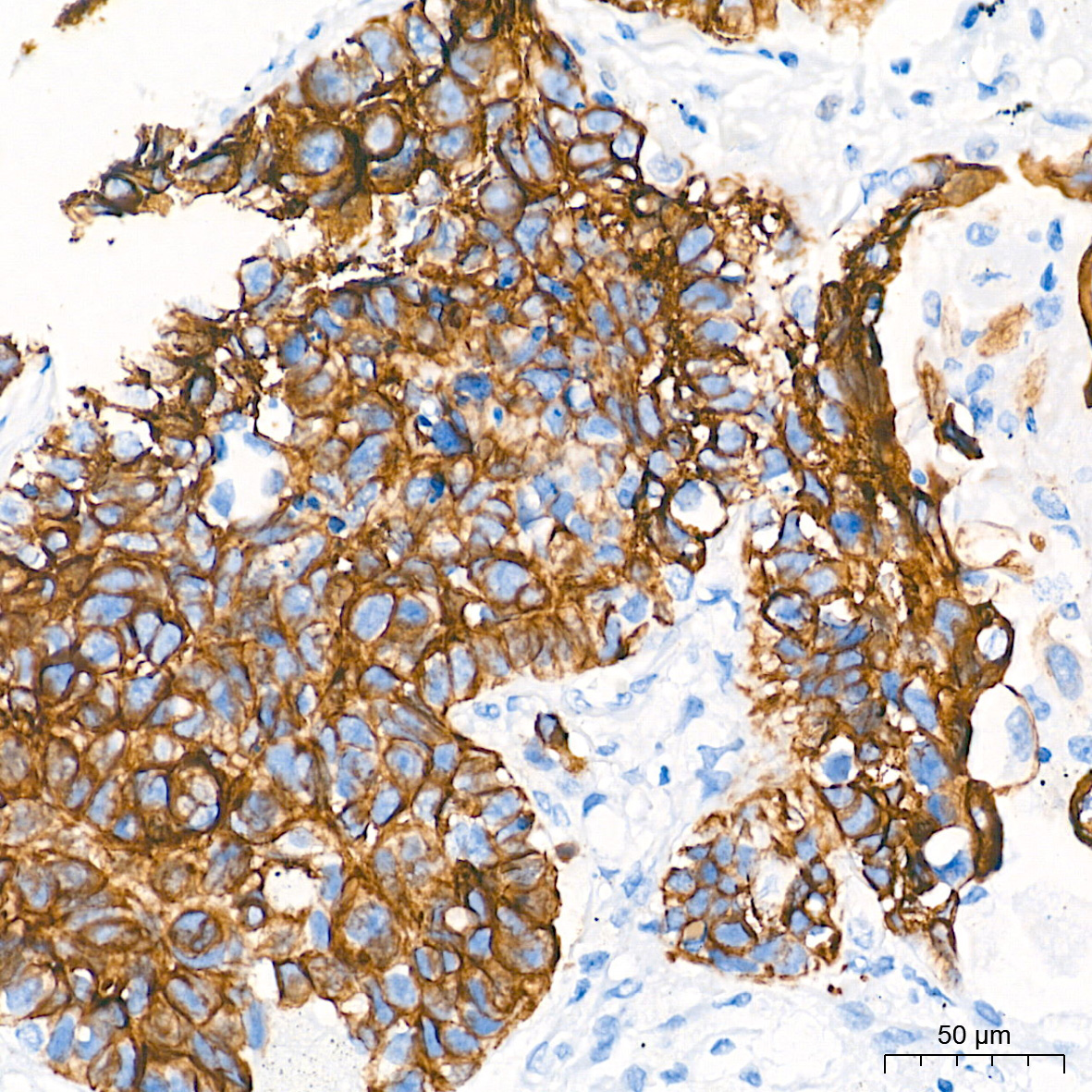 Cytokeratin 6 (KRT6) Rabbit Monoclonal Antibody - Image 3