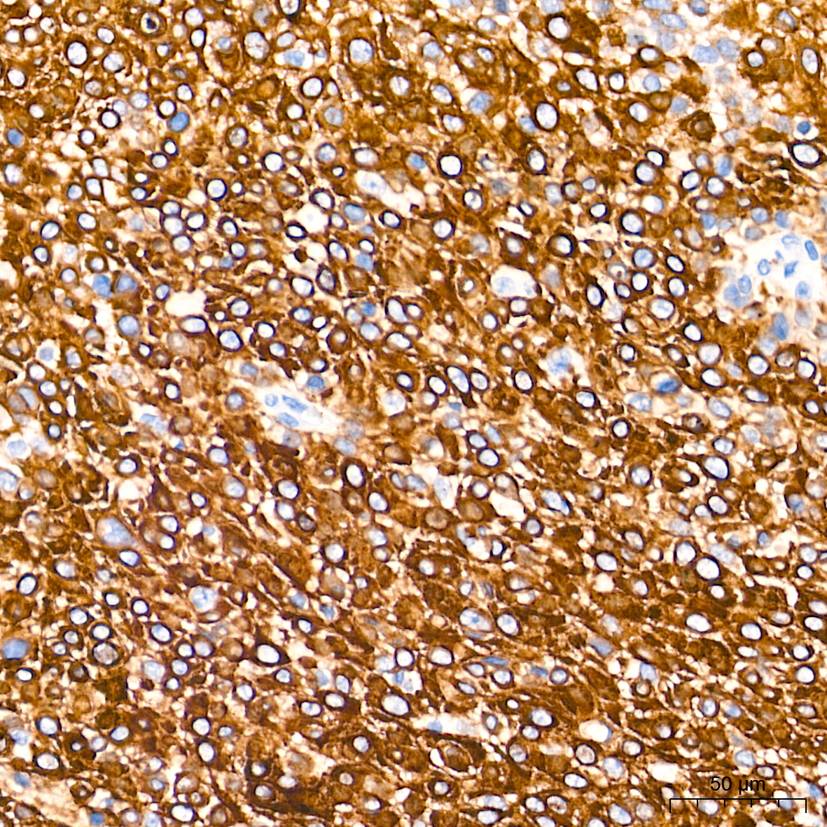Cytokeratin 6 (KRT6) Rabbit Monoclonal Antibody - Image 4