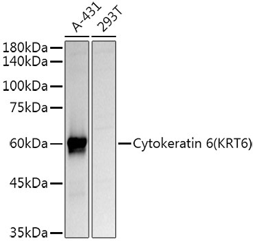 Cytokeratin 6 (KRT6) Rabbit Polyclonal Antibody