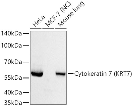 Cytokeratin 7 (CK7) Rabbit Monoclonal Antibody