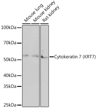 Cytokeratin 7 (KRT7) Rabbit Monoclonal Antibody - Image 2