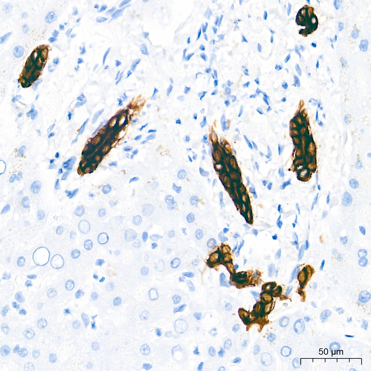 Cytokeratin 7 (KRT7) Rabbit Monoclonal Antibody - Image 3