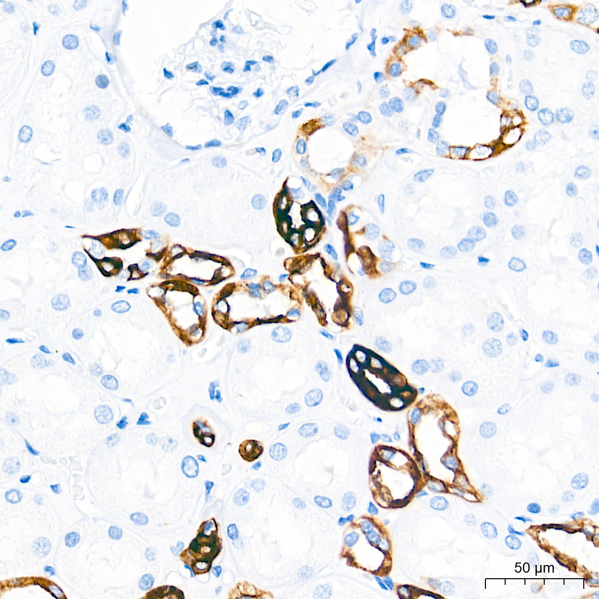 Cytokeratin 7 (KRT7) Rabbit Monoclonal Antibody - Image 4