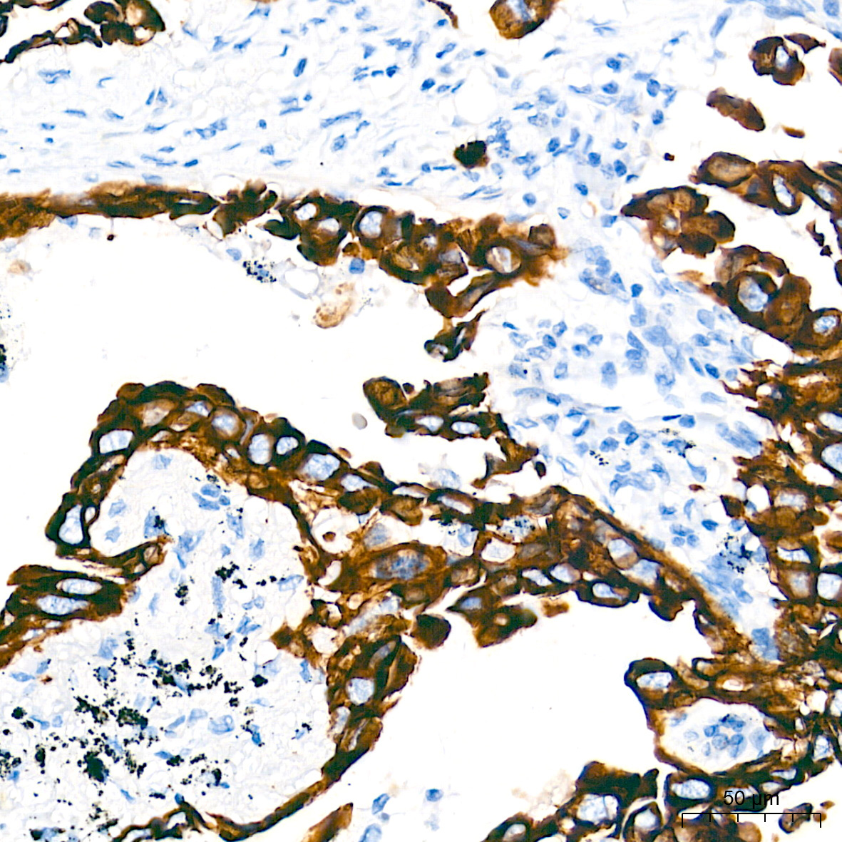 Cytokeratin 7 (KRT7) Rabbit Monoclonal Antibody - Image 5