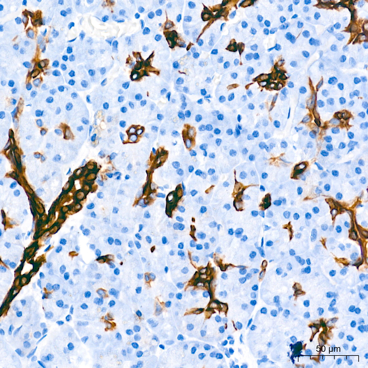 Cytokeratin 7 (KRT7) Rabbit Monoclonal Antibody - Image 6