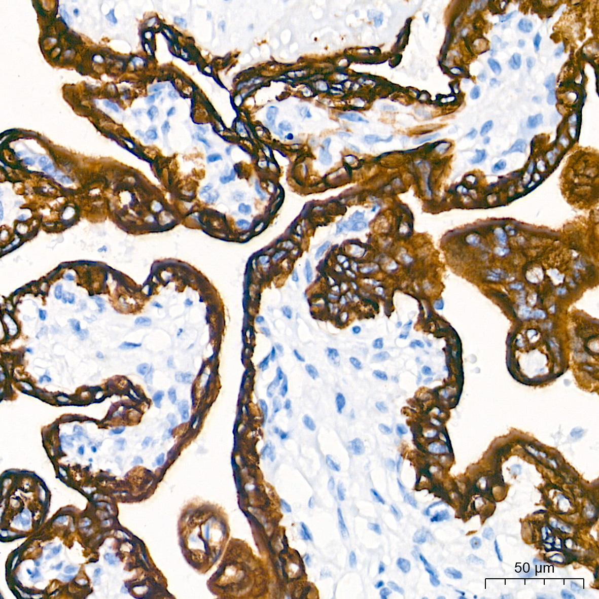Cytokeratin 7 (KRT7) Rabbit Monoclonal Antibody - Image 7