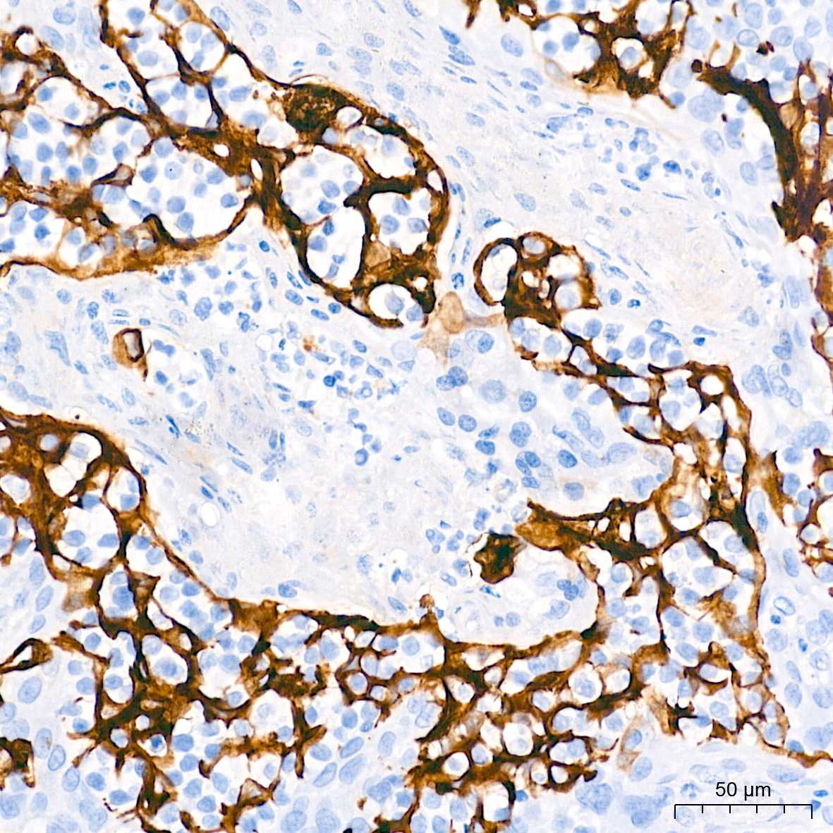 Cytokeratin 7 (KRT7) Rabbit Monoclonal Antibody - Image 8