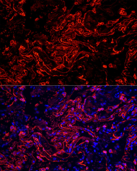 Cytokeratin 7 (KRT7) Rabbit Monoclonal Antibody - Image 9