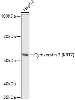 Cytokeratin 7 (KRT7) Rabbit Polyclonal Antibody
