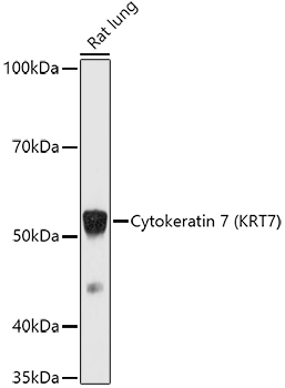 Cytokeratin 7 (KRT7) Rabbit Polyclonal Antibody - Image 2