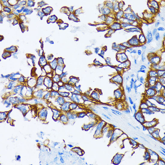 Cytokeratin 7 (KRT7) Rabbit Polyclonal Antibody - Image 3