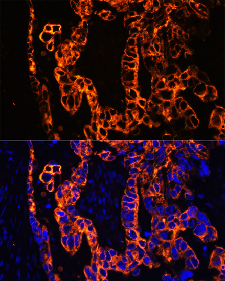 Cytokeratin 7 (KRT7) Rabbit Polyclonal Antibody - Image 4