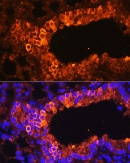 Cytokeratin 7 (KRT7) Rabbit Polyclonal Antibody - Image 5