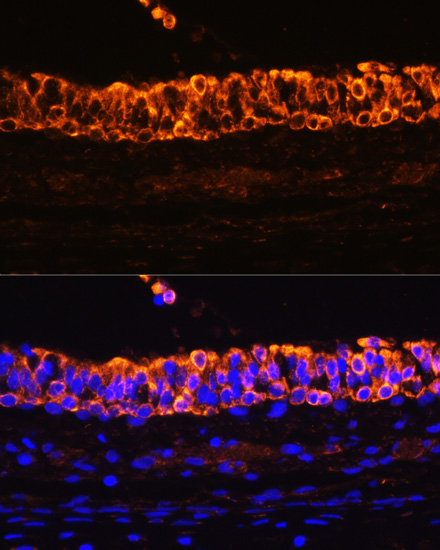 Cytokeratin 7 (KRT7) Rabbit Polyclonal Antibody - Image 6