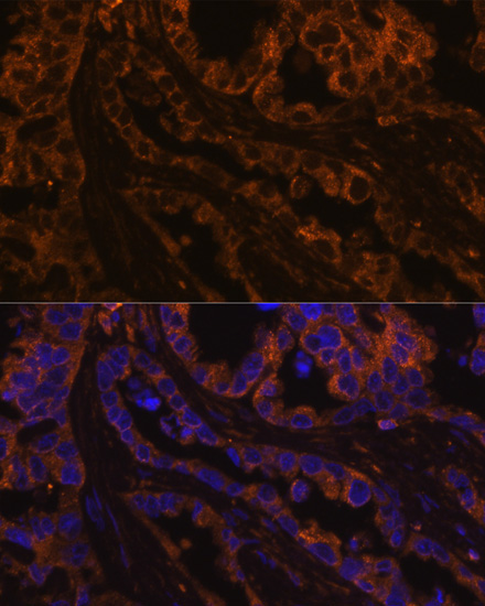 Cytokeratin 7 (KRT7) Rabbit Polyclonal Antibody - Image 2