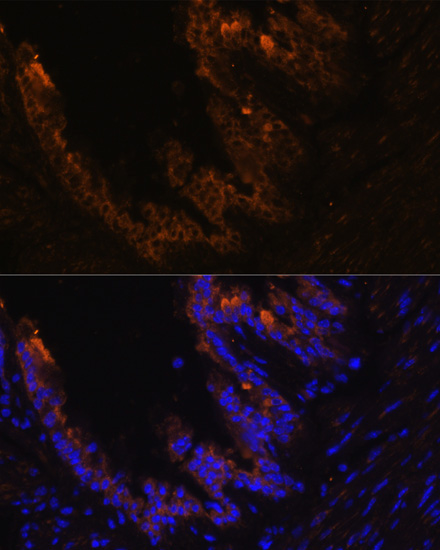 Cytokeratin 7 (KRT7) Rabbit Polyclonal Antibody - Image 3