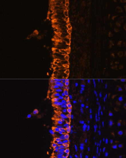 Cytokeratin 7 (KRT7) Rabbit Polyclonal Antibody - Image 4