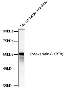 Cytokeratin 8 (KRT8) Rabbit Polyclonal Antibody