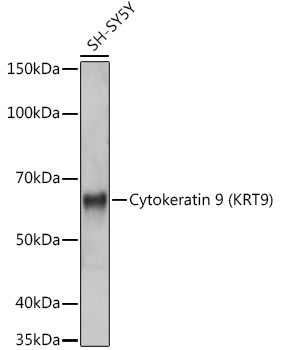 Cytokeratin 9 (KRT9) Rabbit Monoclonal Antibody