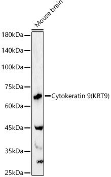 Cytokeratin 9 (KRT9) Rabbit Polyclonal Antibody