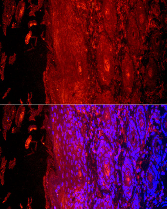 Cytokeratin 9 (KRT9) Rabbit Polyclonal Antibody - Image 2