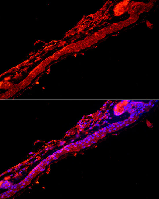 Cytokeratin 9 (KRT9) Rabbit Polyclonal Antibody - Image 3