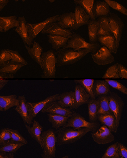 DAAM2 Rabbit Polyclonal Antibody - Image 2