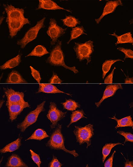 DAAM2 Rabbit Polyclonal Antibody - Image 3