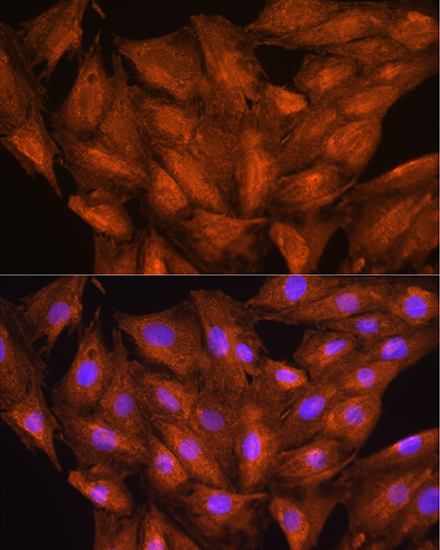DAAM2 Rabbit Polyclonal Antibody - Image 4