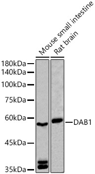 DAB1 Rabbit Polyclonal Antibody