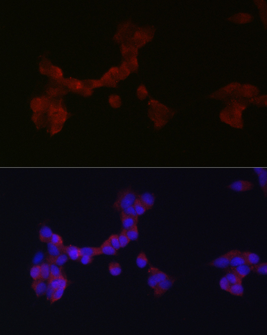 DAB1 Rabbit Polyclonal Antibody - Image 2