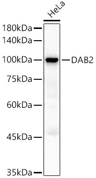 DAB2 Rabbit Polyclonal Antibody