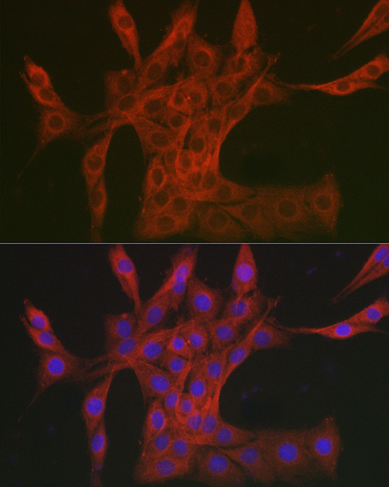 DAB2IP Rabbit Polyclonal Antibody