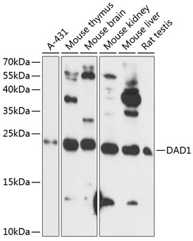 DAD1 Rabbit Polyclonal Antibody