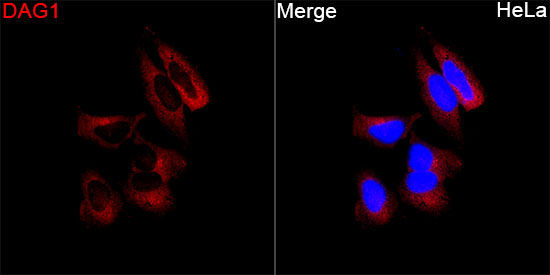 DAG1 Rabbit Polyclonal Antibody - Image 2