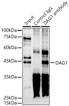 DAG1 Rabbit Polyclonal Antibody - Image 3