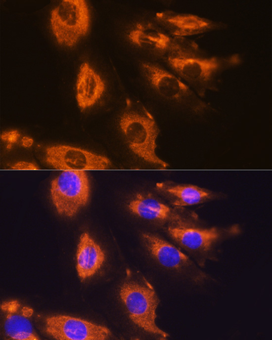 DAG1 Rabbit Polyclonal Antibody - Image 2