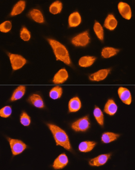 DAG1 Rabbit Polyclonal Antibody - Image 3