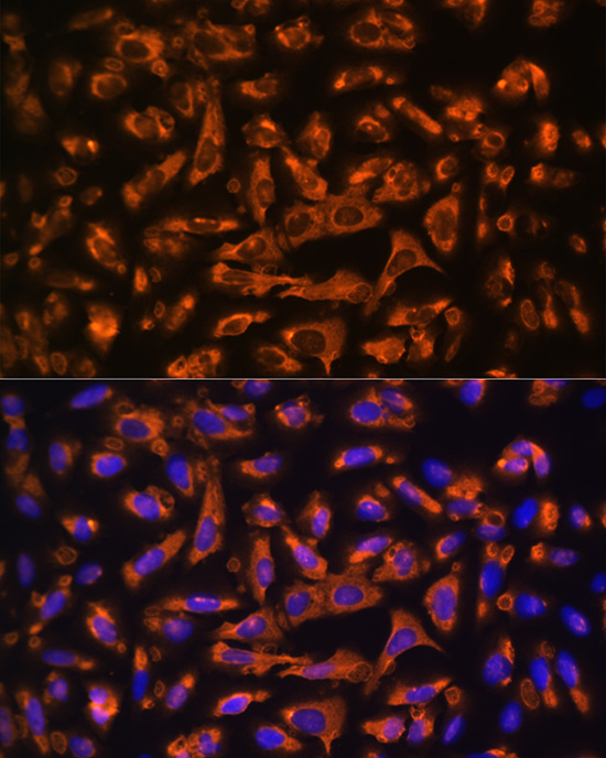DAG1 Rabbit Polyclonal Antibody - Image 4
