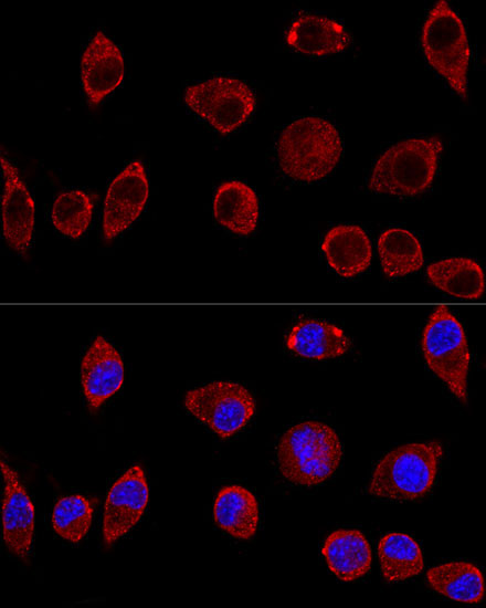 DAO Rabbit Polyclonal Antibody - Image 2