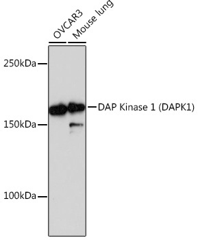 DAP Kinase 1 (DAPK1) Rabbit Monoclonal Antibody